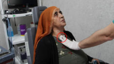 Denizli’de boğazı delik hayatını kabusa çevirdi! 30 yıl sonra…