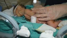 Bebeğe 2.5 saatlik operasyonla makat yapıldı