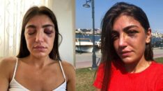 Manken Gizem Akbaş’ın darbedilmesi davasında yeni gelişme