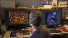 Kök hücre tedavisinde umut ışığı: Ses dalgalarıyla kemik büyütülecek