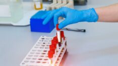 Organ bağışında çığır açan yenilik: Kan grupları tarihe karışıyor