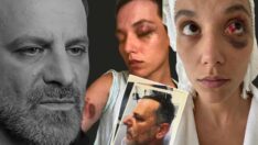 Ozan Güven ve Deniz Bulutsuz davasında Güven’in şoförü dinlendi: Ellerinde çizikler, bacaklarında kesikler vardı