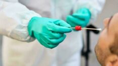 PCR test sonucu ne zaman çıkar? PCR testi ücretli mi?