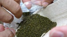 Safra kesesinden çıkanlar şaşırttı! Guinness’e başvuracaklar