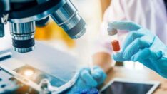 Corona geçirmek kronik böbrek yetmezliği riskini 3 kat artırıyor