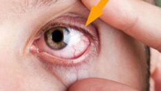 Gözyaşı dökenler daha çabuk iyileşiyor