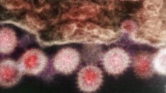 Kırım Kongo geri mi döndü? İngiltere’de Ebola benzeri virüs vakası tespit edildi