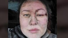 Ukraynalı yüzme antrenörü Aiyna Morozova mucizevi şekilde kurtuldu