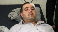 ‘Beni taciz, rahatsız ediyorsun’ diyerek aile hekiminin burnunu kırdı