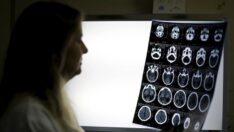 Bilim insanları uyardı: “Hafif geçirilse bile Covid beyne zarar verebiliyor”