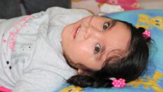 Tek çocuğu ‘Anne’ diyebilsin diye bir umut bekliyor