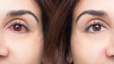 Polen alerjisi baharla sınırlı değil