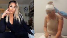 Saçını boyatmak için kuaföre gitti, hayatının kabusunu yaşadı… Deri naklinden sonra yaşadıklarını anlattı