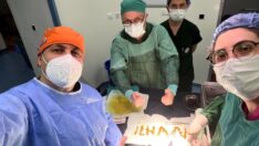 Safra kesesinden çıkanlar şaşırttı!