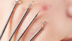 Siyah noktalarınızdan tamamen kurtulabilirsiniz