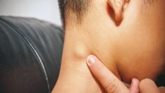 Uzmanlardan maymun çiçeği uyarısı: Vücudunuzun dört yerinden birinde bu belirti varsa doktora gidin