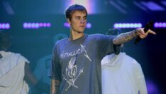 Justin Bieber’dan sevenlerini üzen paylaşım: “Yüzümün bir tarafı felçli”