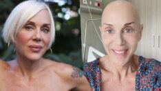 Kanserle mücadele eden Billur Kalkavan: Her gün daha iyiye gidiyorum