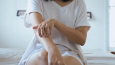 Maymun çiçeği belirtileri neler? Maymun çiçeği nasıl bulaşır, Türkiye’de var mı?