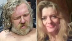 2 yıl sonra komadan çıkan kadın, saldırıyla ilgili gizemi aydınlattı