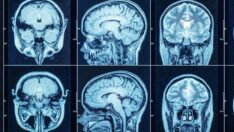 Bilim insanları iyi ve kötü anıların gizemini çözüyor