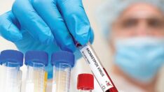 Maymun çiçeği virüsü kimleri tehdit ediyor?