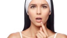 Uçuğun sebebi Bronz Çağ’daki öpüşme alışkanlıkları olabilir mi?