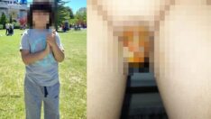 Yanlış sünnet iddiası! Küçük çocuğun hayatı karardı