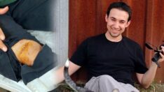 Hastanede makasla sağlık çalışanını yaraladı