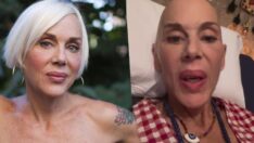 Kanserle mücadele eden Billur Kalkavan zatürre oldu