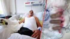Kopan parmaklarını poşetle hastaneye götürdü, 12 saatte dikildi