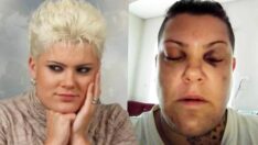 Popstar Evren’i bu hale getirdiler