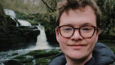 Türkiye’de de vaka sayıları artıyor… Maymun çiçeğine yakalanan adamdan Covid mesajı