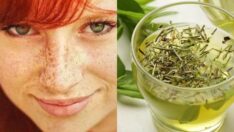 Yüzünüzdeki çiller yaşlandığınızı gösterir! Çözüm: 1 tatlı kaşığı yeşil çay maskesi