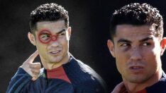 Cristiano Ronaldo’nun yüzündeki morluklar hayranlarını şaşırttı