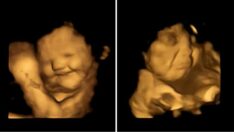 Havuç gülümsetti, lahanayı sevmediler… Anne karnındaki bebekler şaşırttı