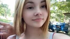 Suya karşı alerji geliştiren genç kızın hayatı kabusa döndü