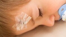 Yara bandı benzeri teknolojik sıva acısız tedavi imkanı sunuyor