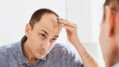 Kelliğin çözümü bulundu: Laboratuvarda saç yarattılar