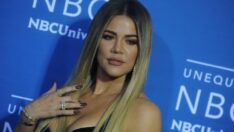 Khloe Kardashian yüzündeki bandajın sebebini anlattı