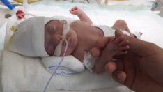 790 gram doğan Ayza bebek mucizeyi yaşattı