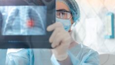 Akciğer kanseri için düzenli tarama yaptırmak hayati önem taşıyor