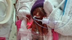 Arden bebek 710 gram doğdu ama başardı