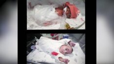 Dünyaya 460 gram gelen bebek 137 günlük mücadeleyle yaşama tutundu