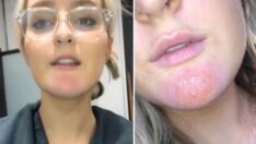 Erkek arkadaşından enfeksiyon kaptı, internetten çağrı yaptı