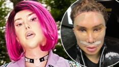 Instagram fenomeninin inanılmaz değişimi: Koreli kadından İngiliz erkeğe…