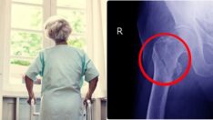 Kadınlar kalça kırığı riskini nasıl azaltabilir?