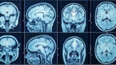 Nöbet geçiren adam Fransızca konuşmaya başladı