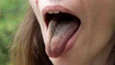 Ünlü gazete yazdı: İşte Covid-19’un olağandışı 5 belirtisi