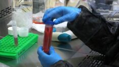 Corona’nın bir etkisi daha ortaya çıktı: Kanseri hızlandırıyor